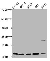 IHC-plus™ CSTB / Cystatin B / Stefin B Antibody