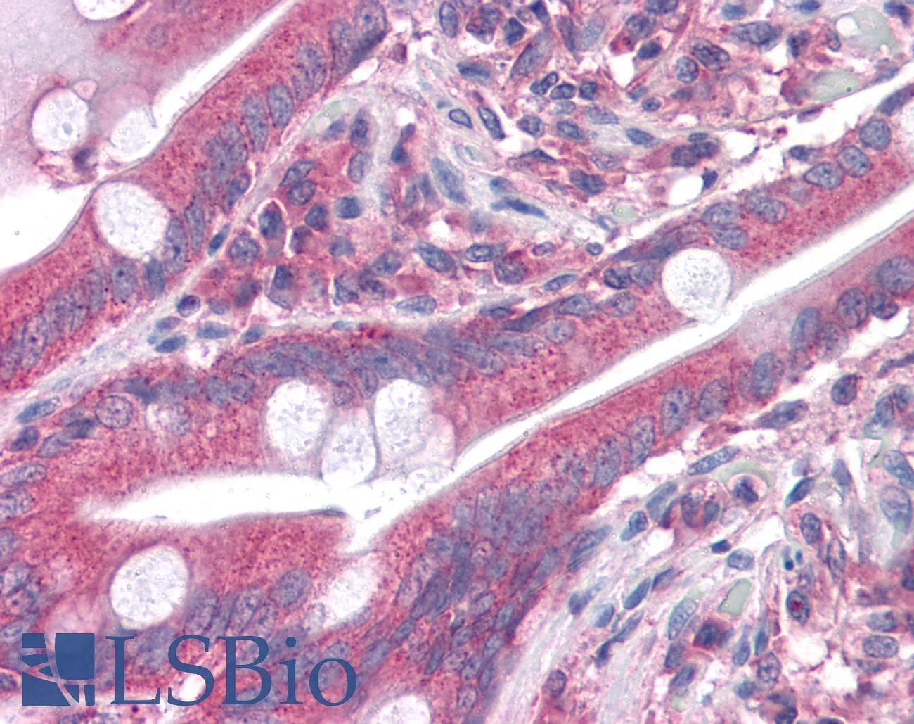 IHC-plus™ GOLM1 / GP73 / GOLPH2 Antibody