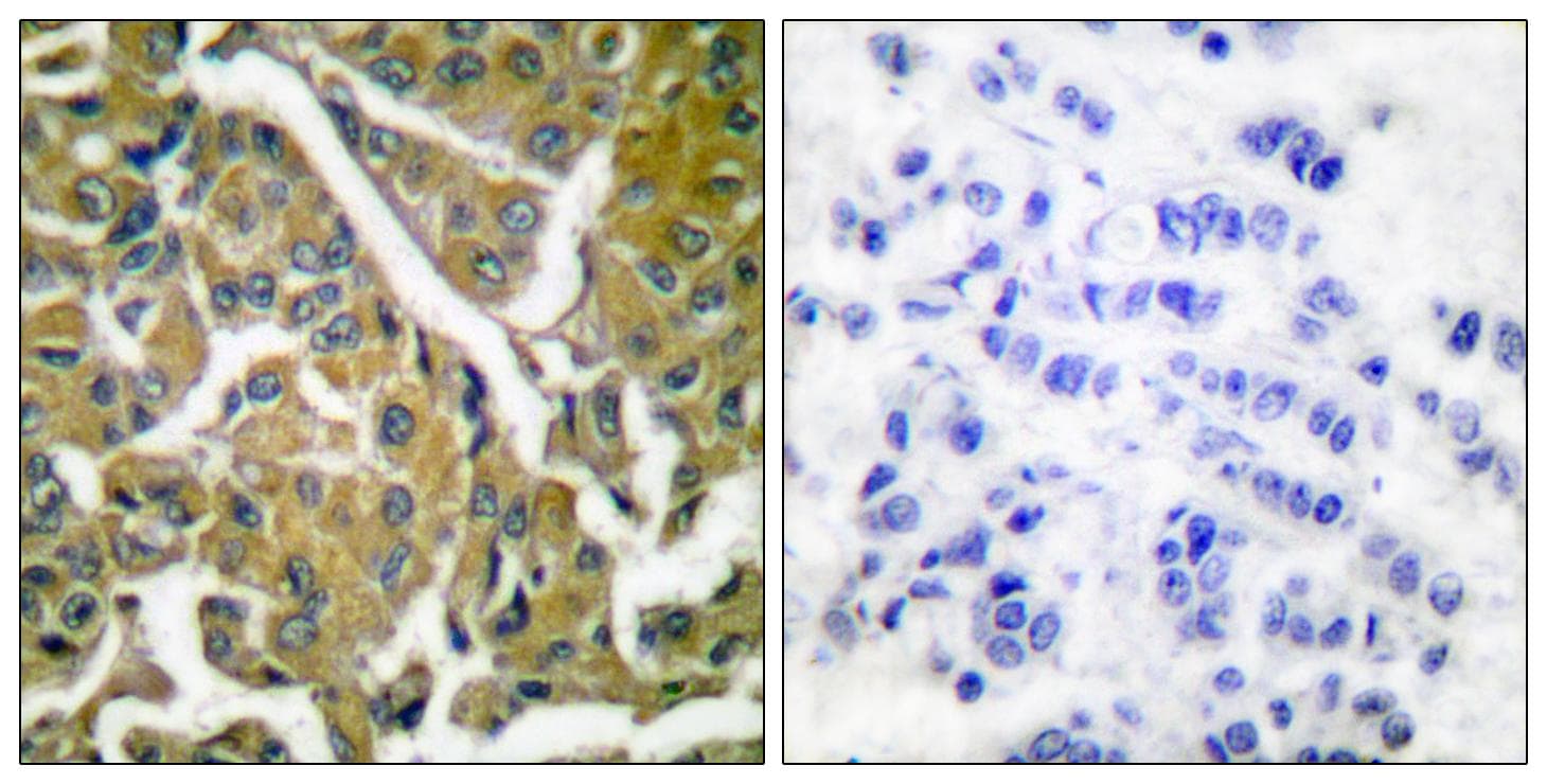 CTNNB1 / Beta Catenin Antibody (p33/37)