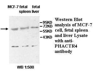 Polyclonal Rabbit anti-Human PHACTR4 Antibody (aa139-378, IHC, WB)