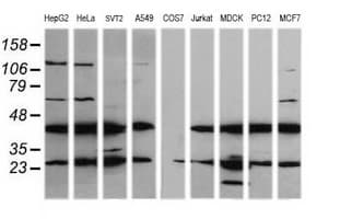 MAP2K1 / MKK1 / MEK1 Antibody (clone OTI4H1, Carrier-free)