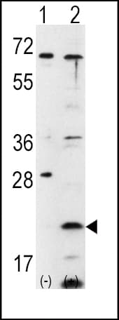 Polyclonal Rabbit anti-Human FXN / Frataxin Antibody (aa143-172, IHC, WB)