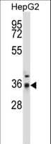 PPP4C Antibody (aa160-189)