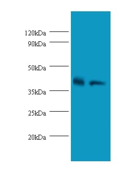 QPCT / QC Antibody (Biotin)