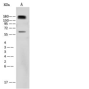 EGFR Antibody
