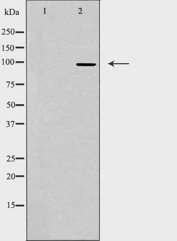Polyclonal Rabbit anti-Human TOP3B Antibody (IF, WB)