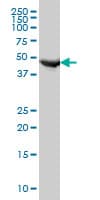IHC-plus™ FH / Fumarase / MCL Antibody (clone 3E7)