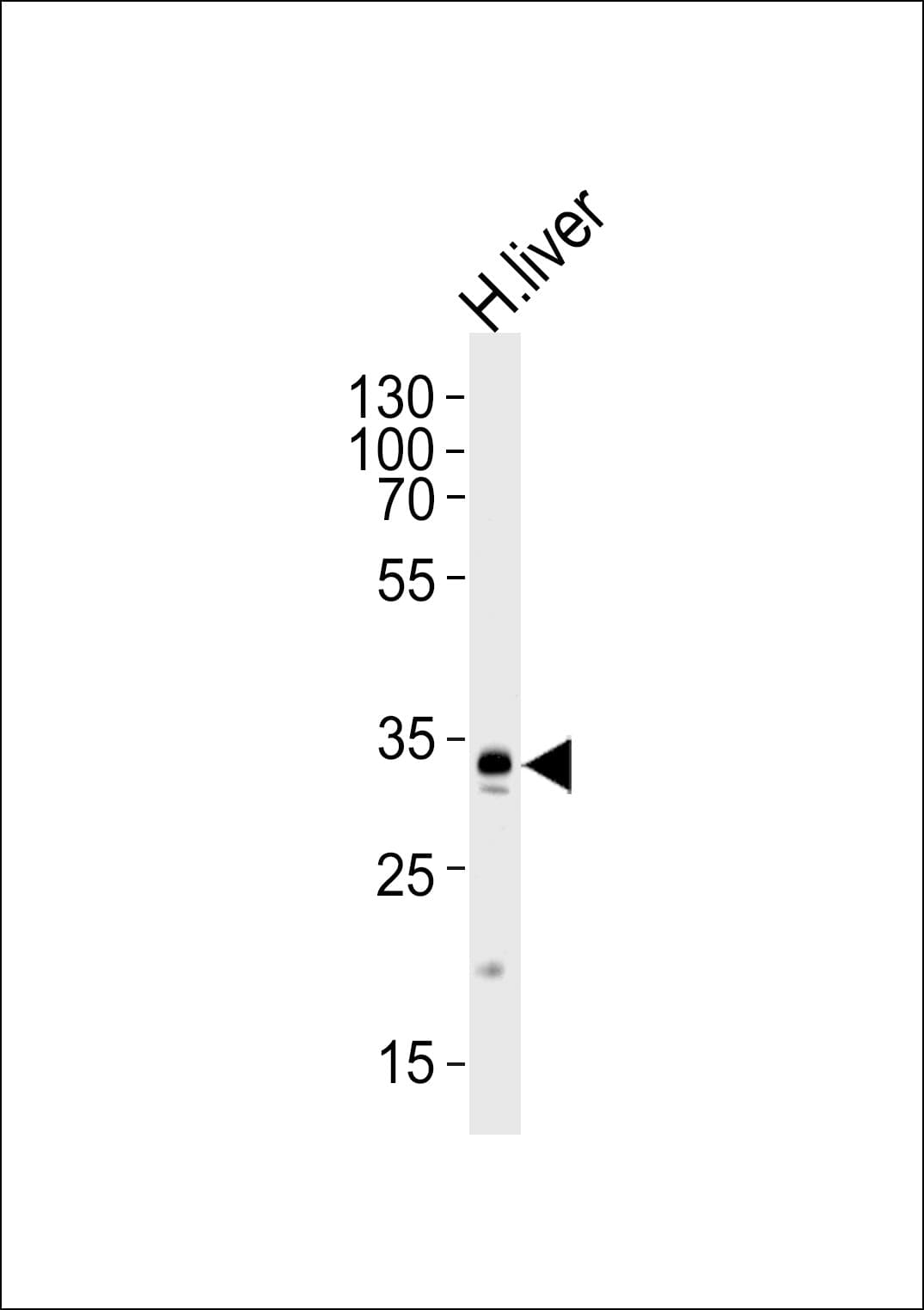 GPD1 Antibody (aa28-57)