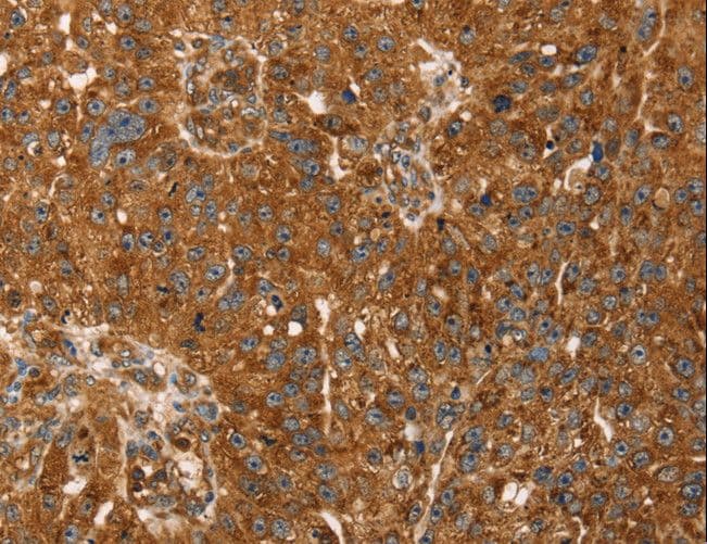 TBC1 / TBC1D1 Antibody