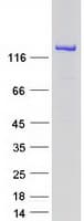 Human OCRL Protein (Recombinant Myc-DDK (Flag))