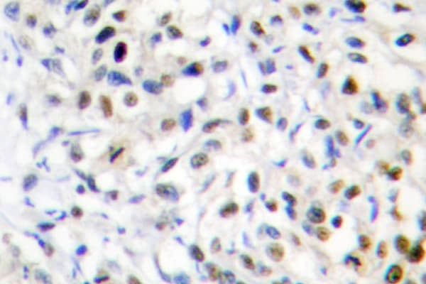 DNMT3B Antibody (His7)