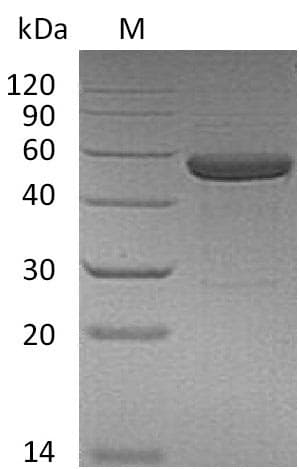 Human IL15 Receptor Alpha + IL15 Fusion Protein (Recombinant Fc, C-terminus)