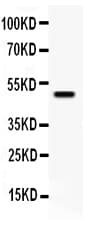 YBX1 / YB1 Antibody (aa137-152)