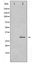 RPA2 / RFA2 / RPA34 Antibody