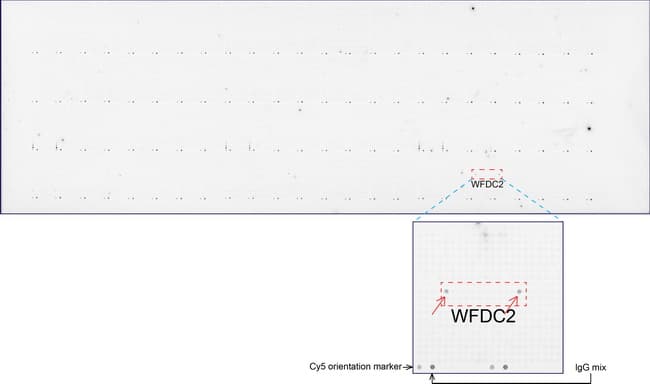 Monoclonal Mouse anti-Human WFDC2 / HE4 Antibody (clone UMAB87, Carrier-free, aa31-124, IHC)