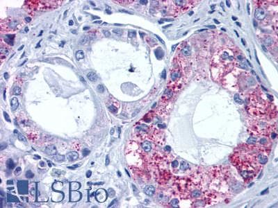 PathPlus™ Polyclonal Rabbit anti-Human GPR6 Antibody (C-Terminus, IHC)