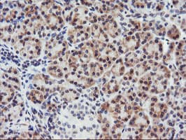 APMAP / C20orf3 Antibody (clone OTI1G8)