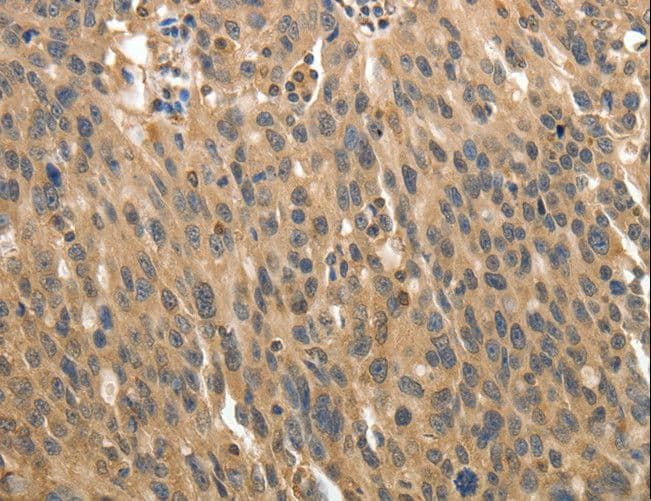 MSN / Moesin Antibody