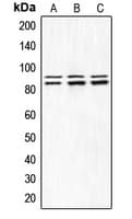 Polyclonal Rabbit anti-Human IKK Alpha+Beta Antibody (phospho-Ser180/Ser181, IHC, WB)