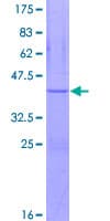 Human ATP5J Protein (Recombinant GST)
