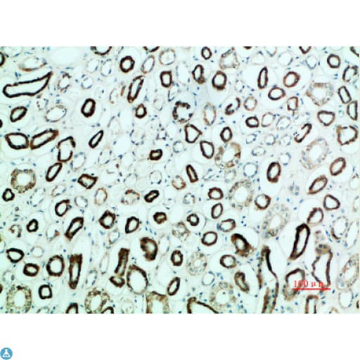 Polyclonal Rabbit anti-Human PTHR / PTHR1 Antibody (WB)