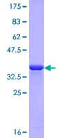 Human Corneodesmosin / CDSN Protein (Recombinant GST, N-terminus)