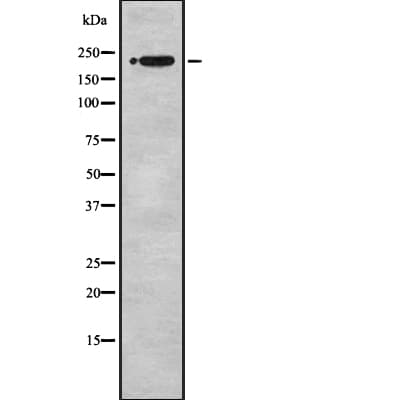 Polyclonal Rabbit anti-Human SCN2A / Nav1.2 Antibody (IHC, WB)