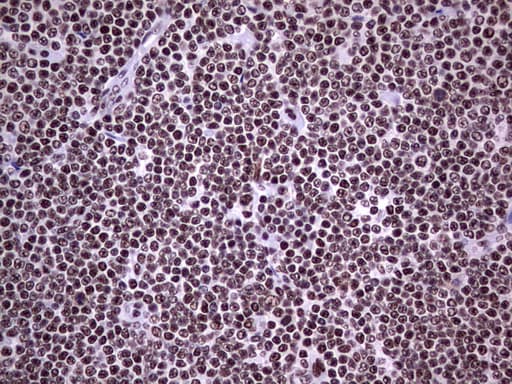 Monoclonal Mouse anti-Human PPP1R8 / Rnase E Antibody (clone OTI4E5, aa1-225, IHC, WB)