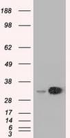 EMG1 / NEP1 Antibody (clone OTI1B8)