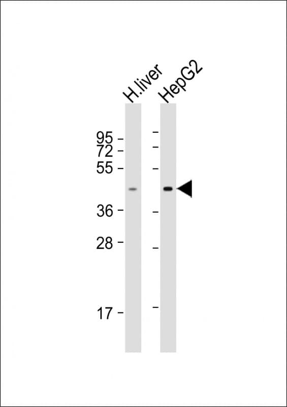 Polyclonal Rabbit anti-Human TMPRSS11D / HAT Antibody (aa84-119, WB)