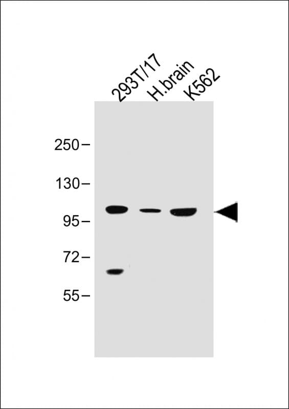 SLC14A2 / UTR Antibody (N-Terminus)