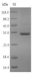 Human PDXP / Pyridoxal Phosphatase Protein (Recombinant 6His, N-terminus)