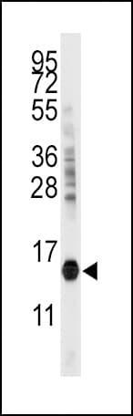 CDA / Cytidine Deaminase Antibody (aa118-146)