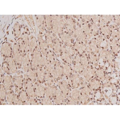 Polyclonal Rabbit anti-Human c-Kit / CD117 Antibody (IHC, IF, WB)