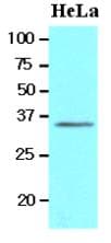 IHC-plus™ BRCC3 / BRCC36 Antibody (clone AT3B1)