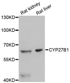 CYP27B1 Antibody