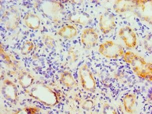 Polyclonal Rabbit anti-Human GATM / AGAT Antibody (aa124-423, IHC, WB)