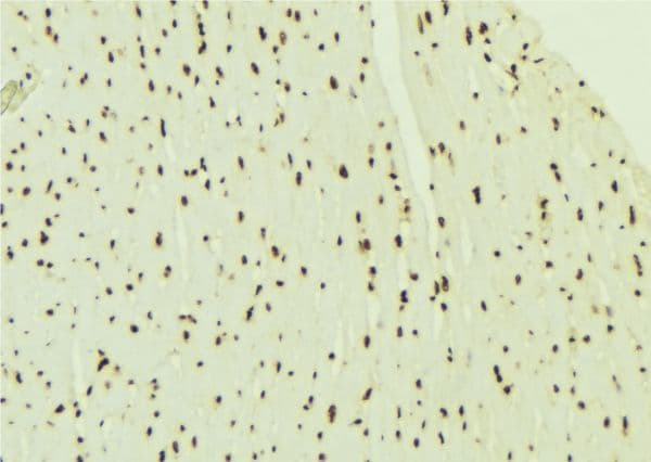 PSMB1 Antibody