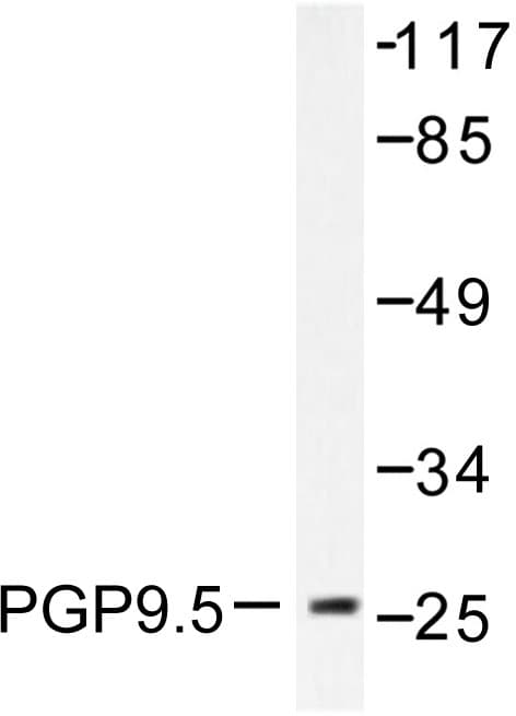 UCHL1 / PGP9.5 Antibody (Arg202)