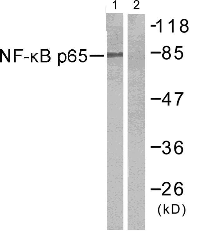 RELA / NFKB p65 Antibody (p311)