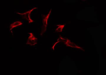 Polyclonal Rabbit anti-Human CANX / Calnexin Antibody (IHC, IF, WB)