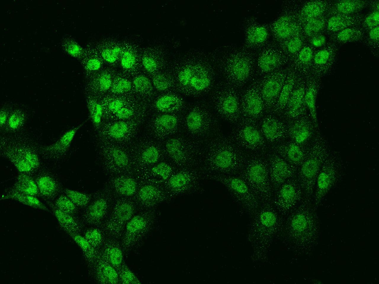 Polyclonal Rabbit anti-Human STAG1 / SA1 Antibody (IF)
