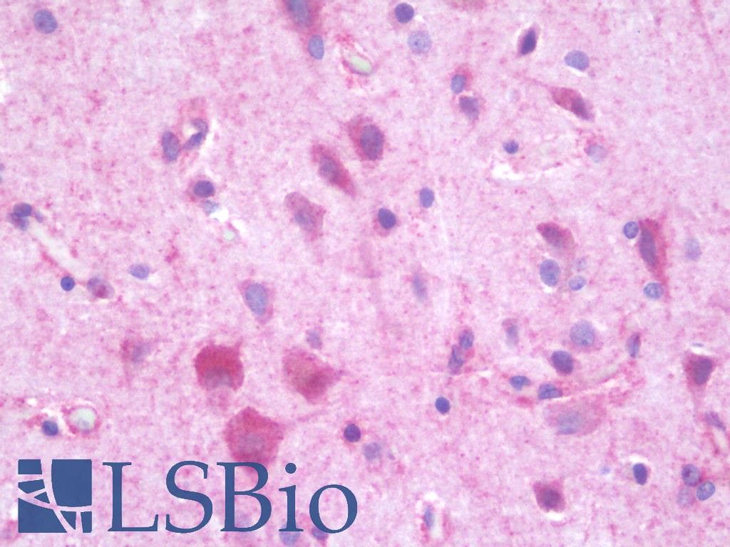 IHC-plus™ CEP135 Antibody (aa1081-1130)