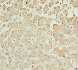 AKR7A2 / AFAR Antibody