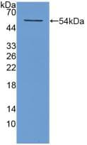 Human NT5E / eNT / CD73 Protein (Recombinant His, N-Terminal)