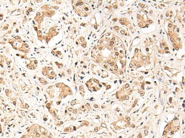 GPR139 Antibody