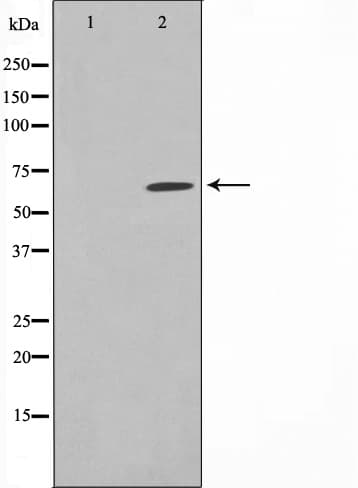PIAS1 Antibody