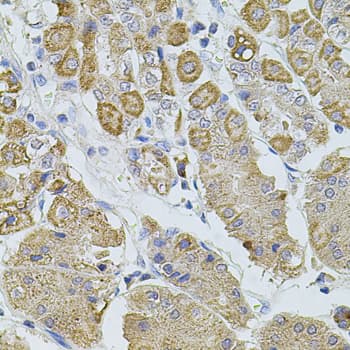 TRPA1 Antibody