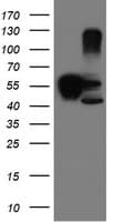 SERPINB1 Antibody (clone OTI4B3)