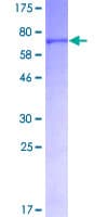 Human LIPG / Endothelial Lipase Protein (Recombinant GST)